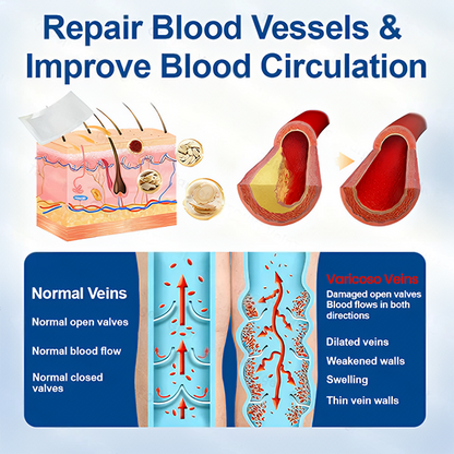 🇬🇧👨‍⚕️✅VeinTarget Microneedle Patch⚡Instant Relief, Long-Term Results