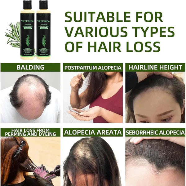 Vitaliaina Rosemary Shampoo
