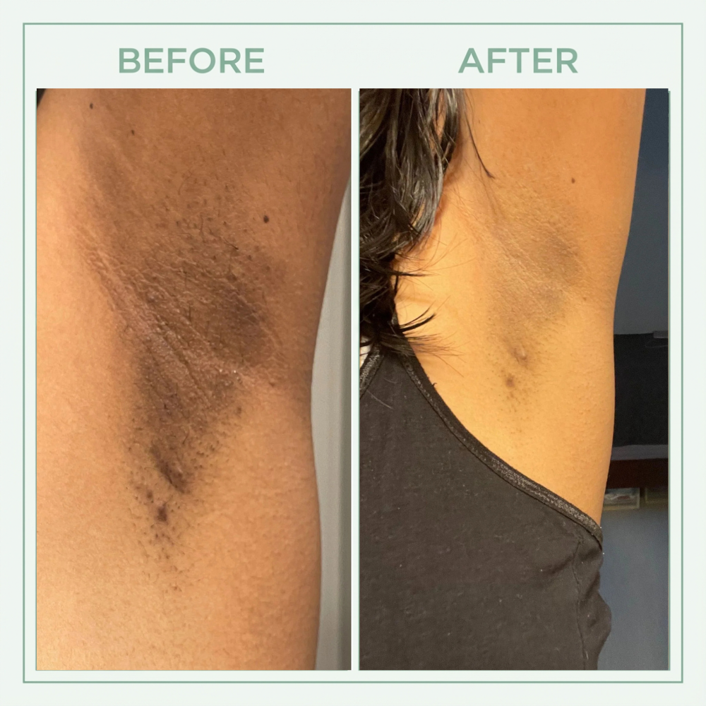 Vitaliaina™ Bright Peel Spray