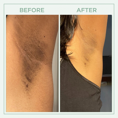 Vitaliaina™ Bright Peel Spray