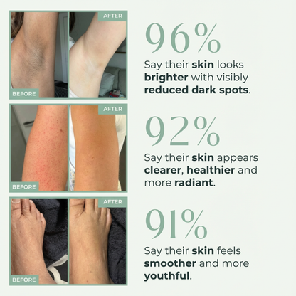 Vitaliaina™ Bright Peel Spray