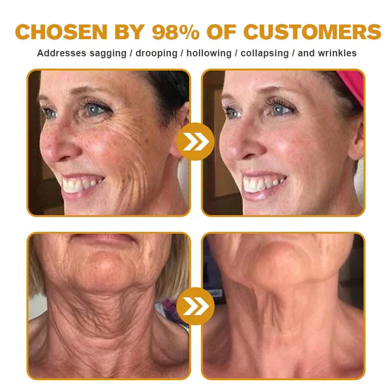 Botox Bee Venom Wrinkle Removal Cream