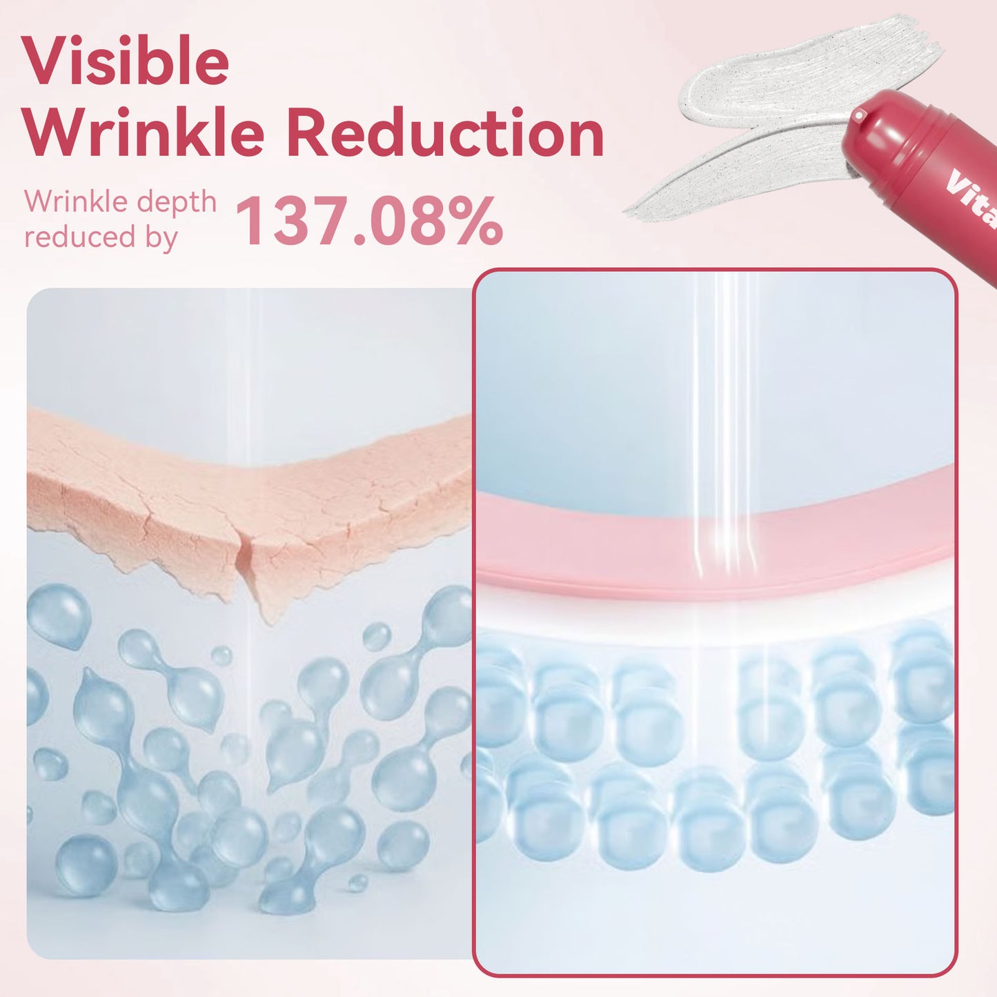 Reverse-aging Adaptive Foundation✨