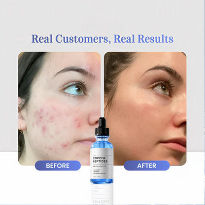 GHK-Cu Copper Peptides Serum