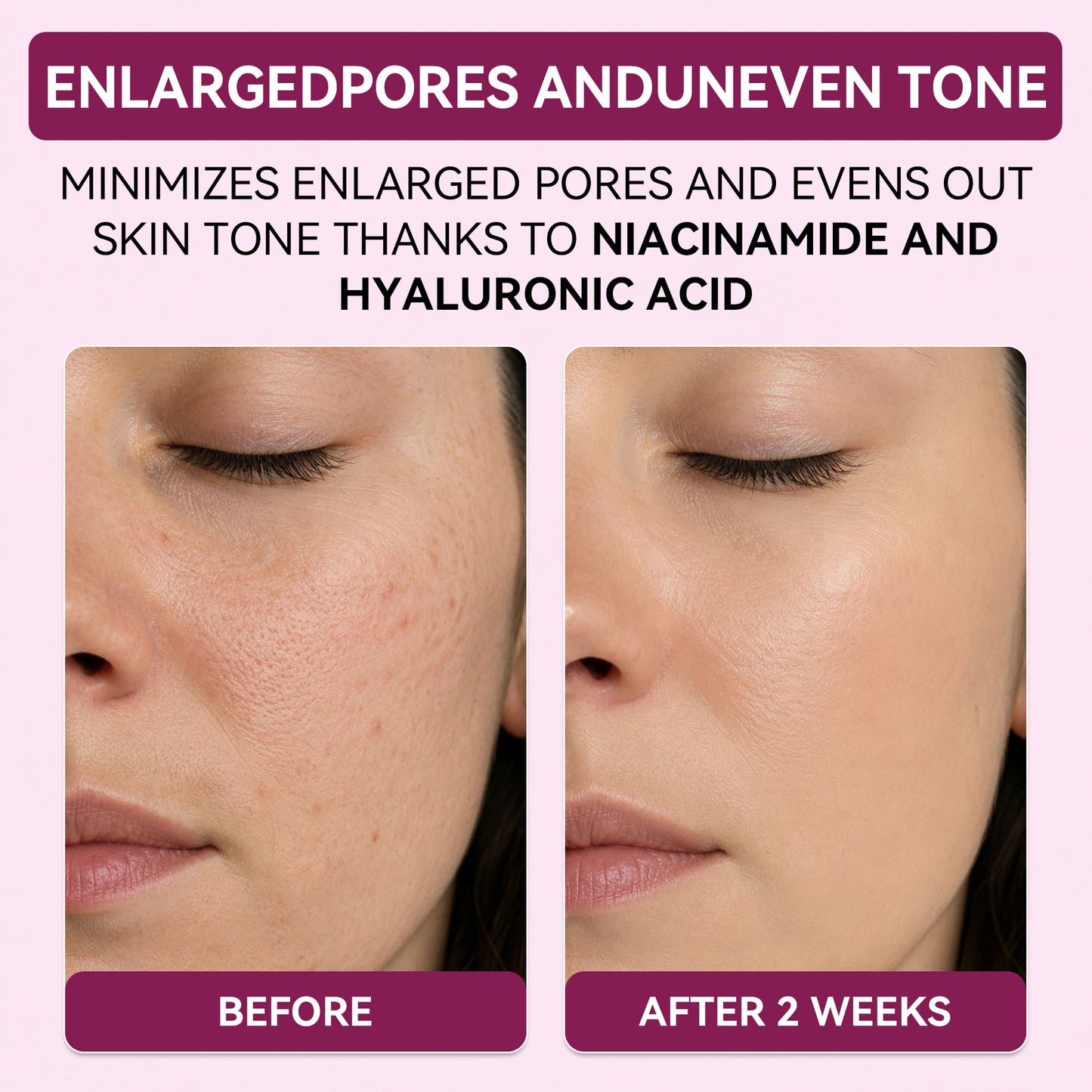 Regenerating Mask with Hydrolyzed Collagen and Niacinamide