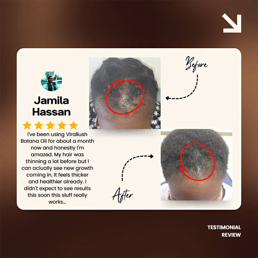 Batana Natural Hair Growth Oil 2.0