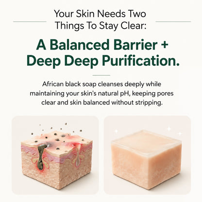 Pure Nilotica Shea Butter by Vitaliaina™