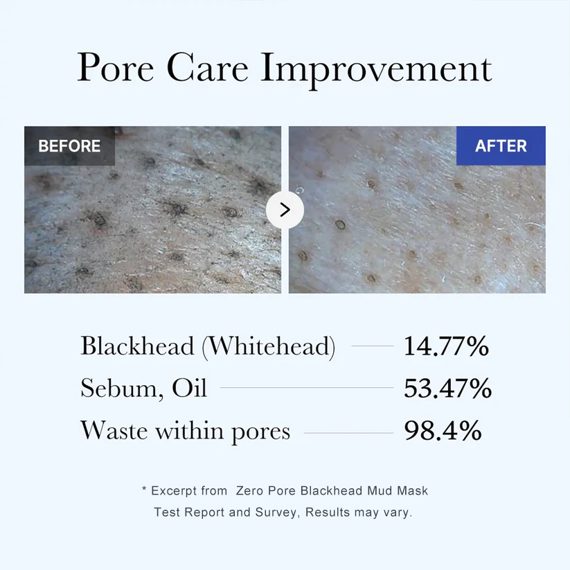 Zero Pore Blackhead Mud Mask-Free Pore Brush