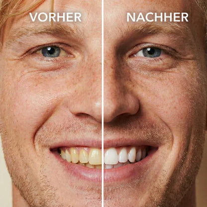 Vitaliaina™ Tooth Polish