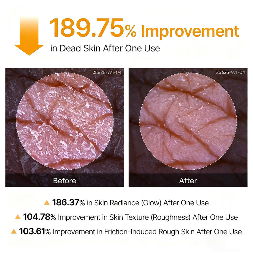 Vitaliaina Peel Shot - Kojic + Turmeric Body Peel Spray