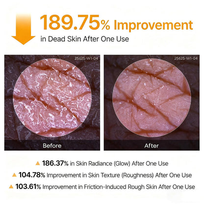 Vitaliaina Peel Shot - Kojic + Turmeric Body Peel Spray