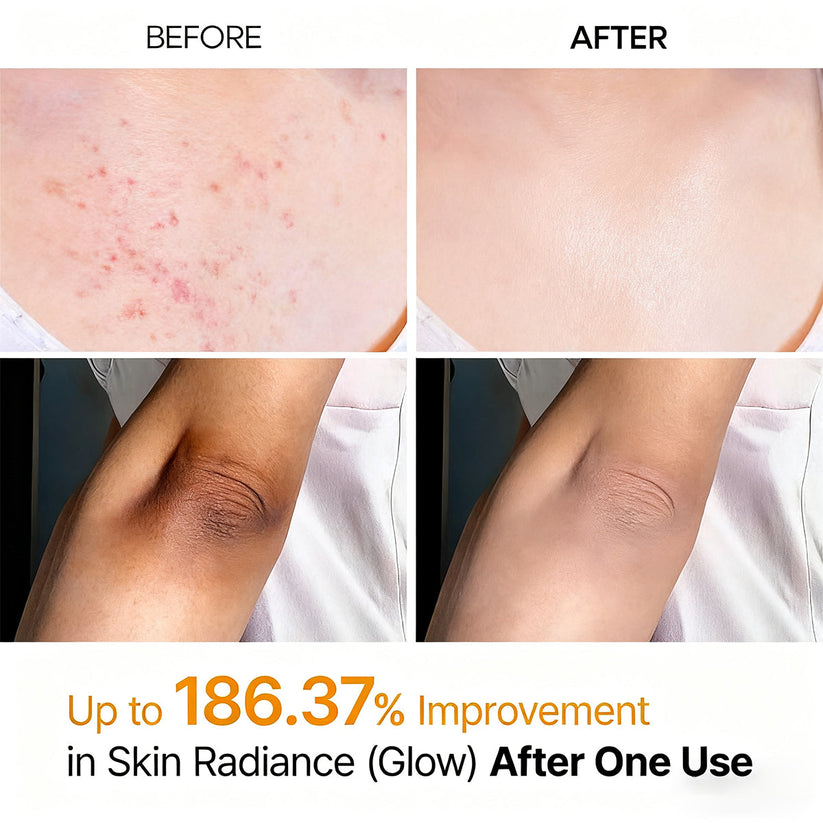 Vitaliaina Peel Shot - Kojic + Turmeric Body Peel Spray