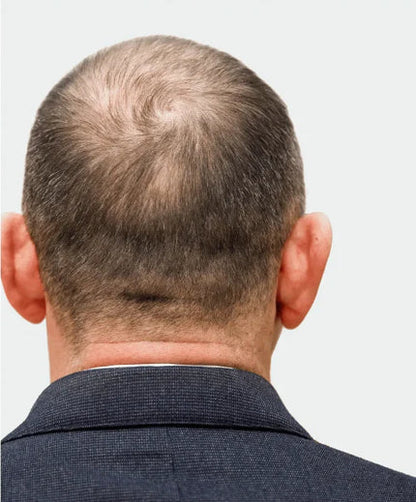 Deoxyribose Scalp Serum