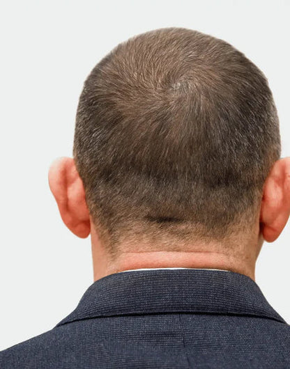Deoxyribose Scalp Serum
