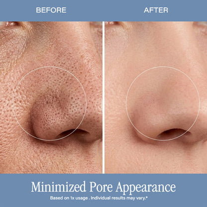 Microdermabrasion Treatment w/ V5 Crystal Technology Facial Exfoliate
