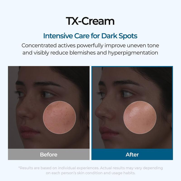 TX - Cream