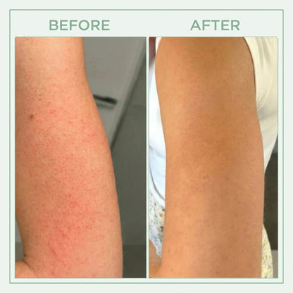 Vitaliaina™ Bright Peel Spray