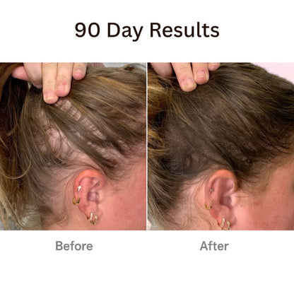 Vitaliaina™ The Natural 4in1 Hair Restoring Brush