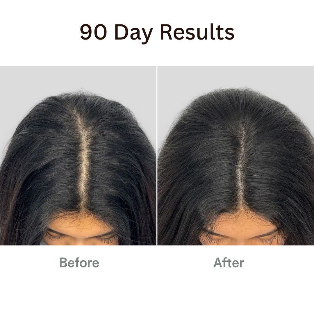 Vitaliaina™ The Natural 4in1 Hair Restoring Brush
