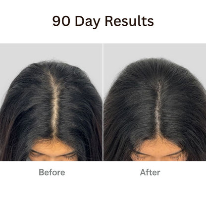 Vitaliaina™ The Natural 4in1 Hair Restoring Brush